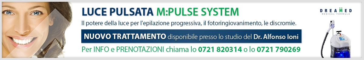 luce pulsata ioni alfonso